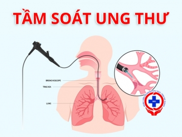 tam soat ung thu